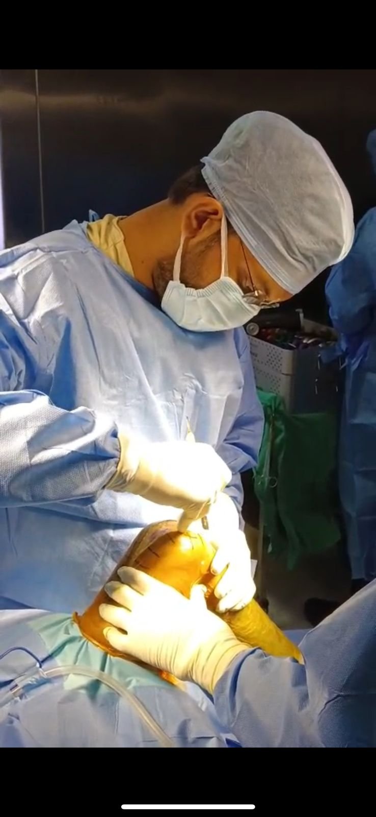 Intra‑operative knee surgery