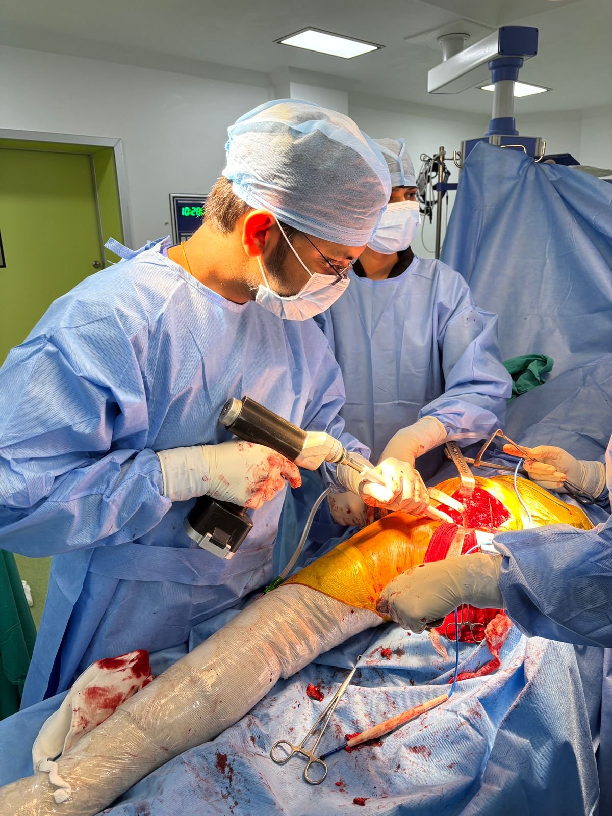 Intra‑operative orthopaedic surgery